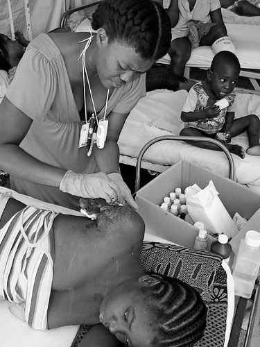 Jeanne finally allows Slande, a volunteer from Florida, to clean and redress her amputation stump at the very busy Hopital d'Etat de la Universite Haiti. Photo: Scott Weinstein