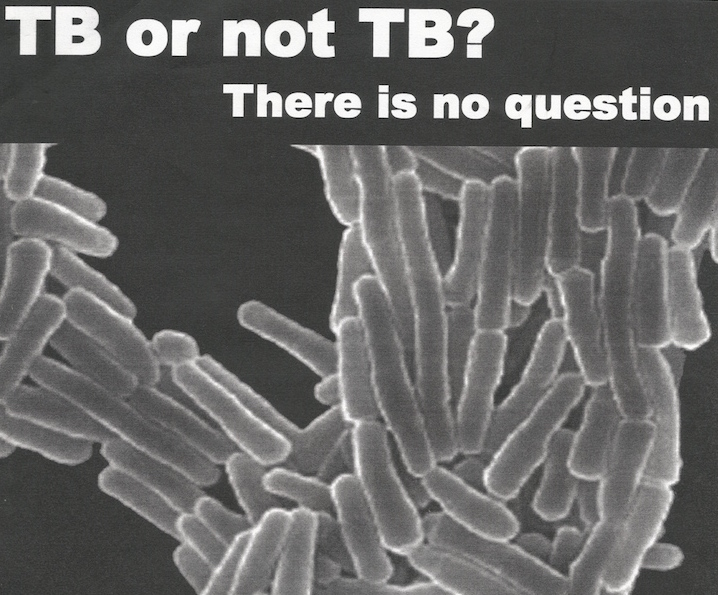 Cover of report, "TB or not TB? There is no question" Image from Toronto Disaster Relief Committee archives