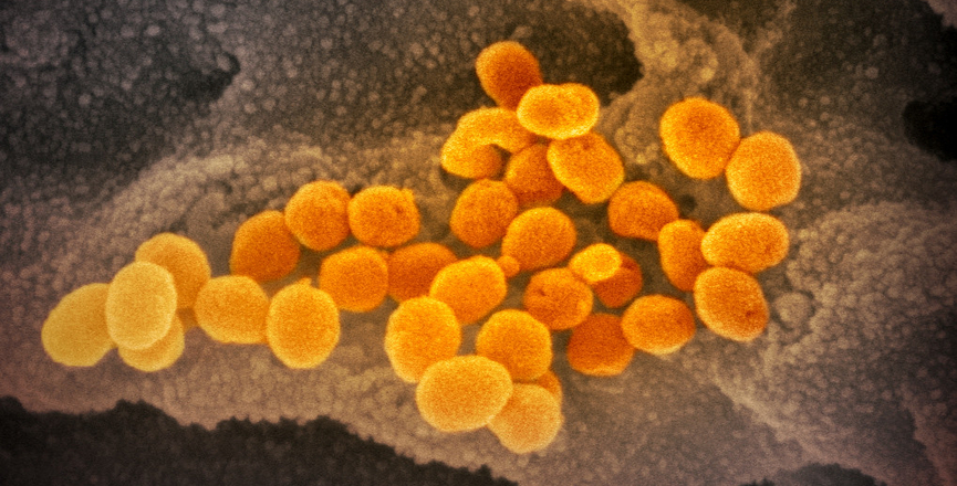 SARS-CoV-2 (orange) -- also known as 2019-nCoV, the virus that causes COVID-19. Image: NIAID/Flickr