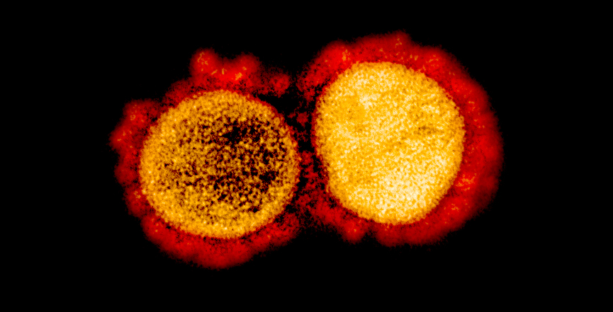 Transmission electron micrograph of SARS-CoV-2 virus particles, isolated from a patient. Image: NIAID/Flickr