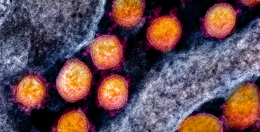 Transmission electron micrograph of SARS-CoV-2 virus particles, isolated from a patient. Image: NIAID/Flickr