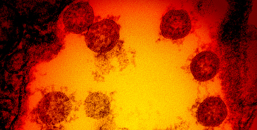 Transmission electron micrograph of SARS-CoV-2 virus particles, isolated from a patient. Image: NIAID/Flickr