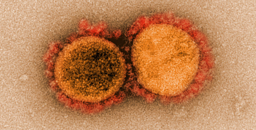 Transmission electron micrograph of SARS-CoV-2 virus particles, isolated from a patient. (Image: NIAID/Flickr)