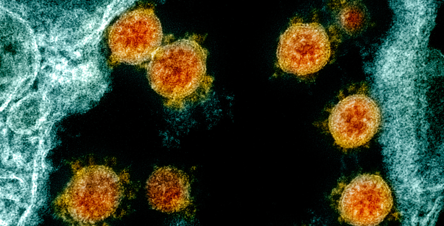 Transmission electron micrograph of SARS-CoV-2 virus particles. Image: NIAID/Flickr