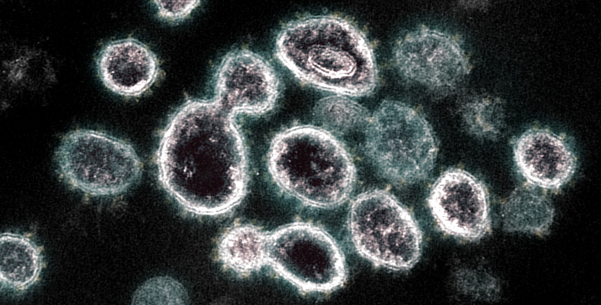 This transmission electron microscope image shows SARS-CoV-2, the virus that causes COVID-19, isolated from a patient in the U.S. Image: NIAID/Flickr