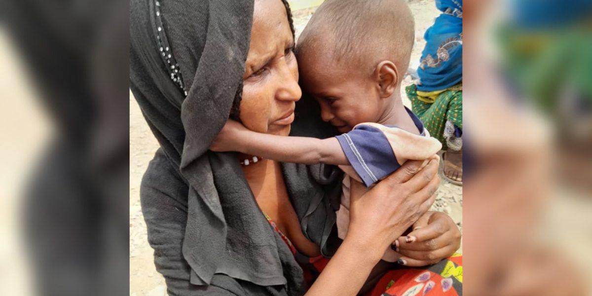 A displaced child from the Tigray region of Ethiopia and their mother.