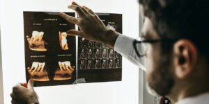 A dentist examining an X-ray of some teeth.