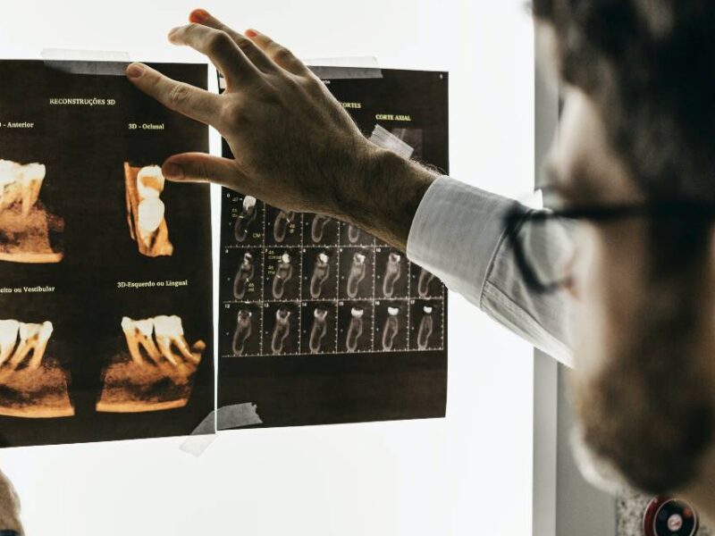 A dentist examining an X-ray of some teeth.