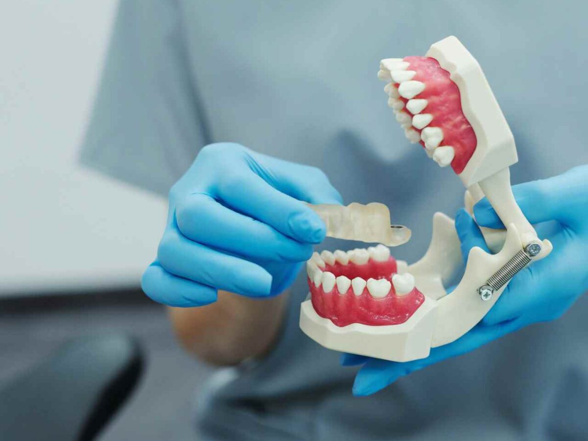 Concerns mount over next stage of dental care plan