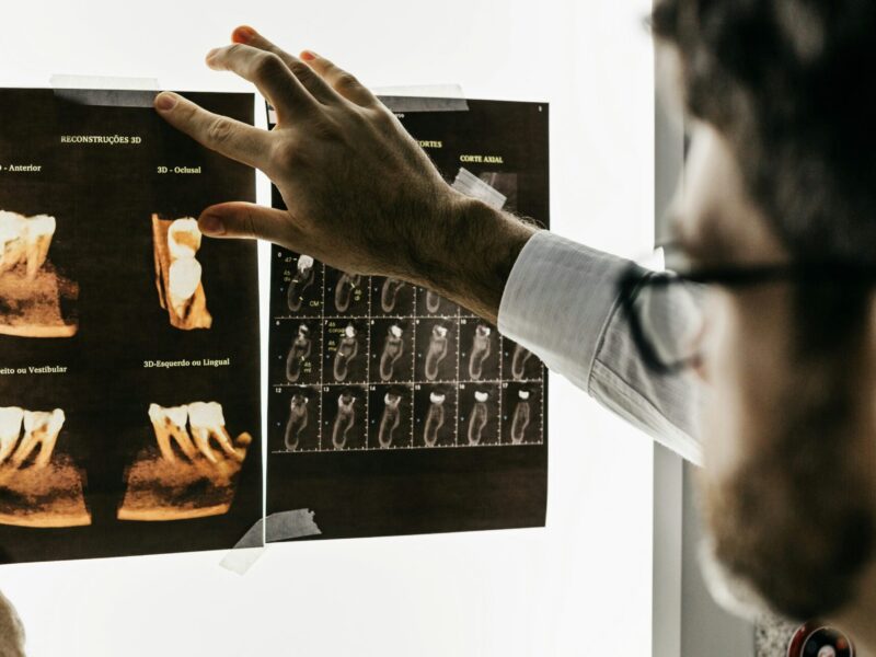 An image of a dentist looking at teeth x-rays. A rule for the Canadian Dental Care Program disproportionately affects workers who have temporary work permits and recent immigrants who are still in the process of family reunification.
